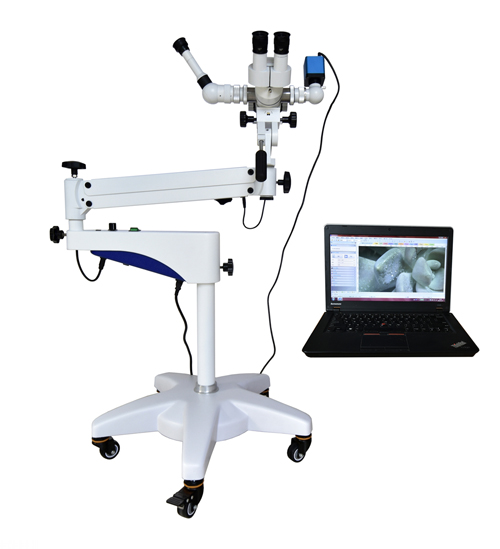 Hot Sale Optical Colposcope