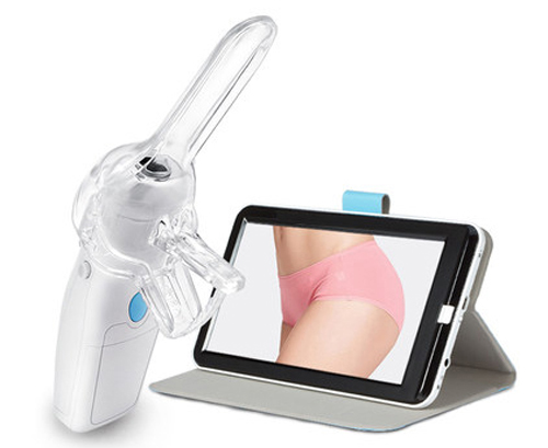 Colposcope optique numérique portable