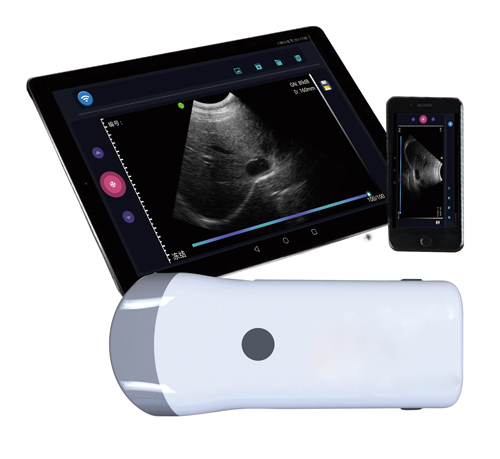 Wireless B-ultrasound detector electronic probe