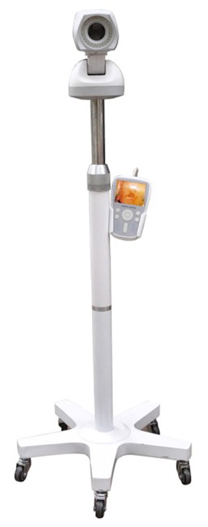 Portable Digital Trolley Colposcope