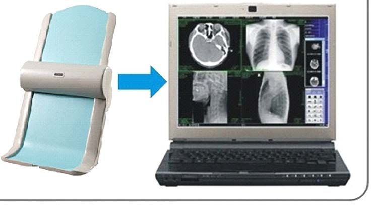 Scanner de films médicaux