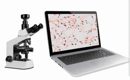 Portable Table top Sperm Quality Analyzer