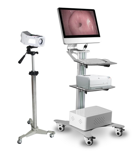 [CCT-SW3304] Digital Optical Colposcope