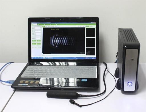 [CCE-200] Ophthalmic ultrasound A/B Scanner