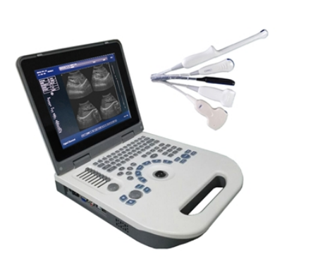 [CCL-50] Full Digital LED Portable Ultrasound